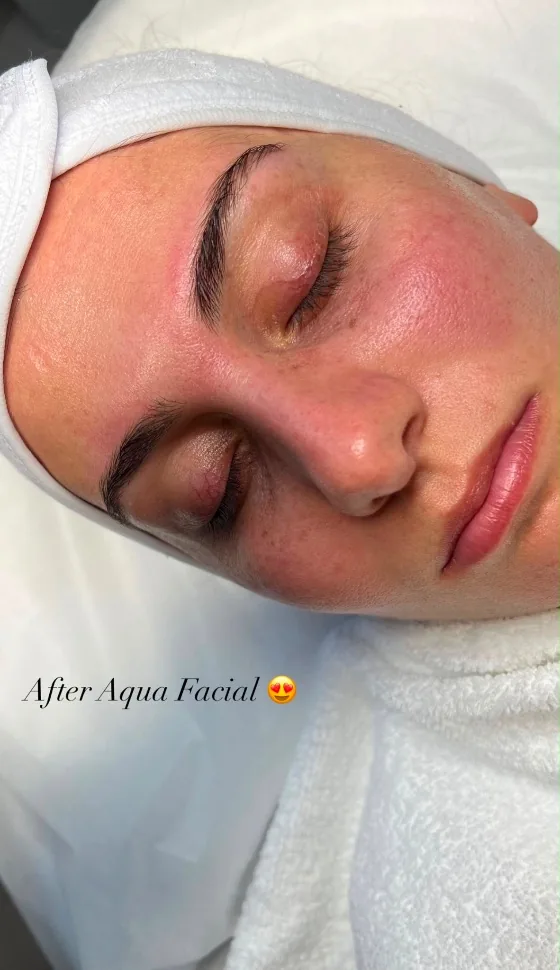 Aqua Facial Ergebnis · PMU Rotenburg (Wümme)