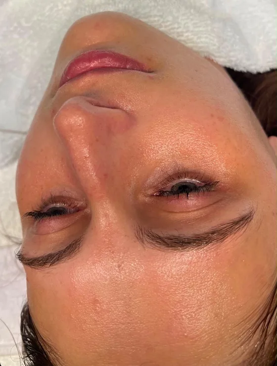 Aqua Facial – frisches Hautbild